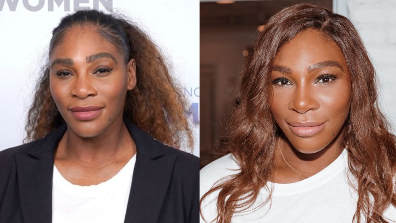 Serena Williams Plastic Surgery Before And After